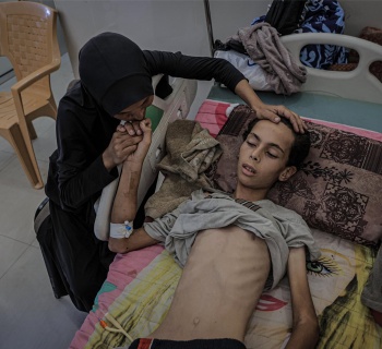 Gaza hladoví. Zatímco svět sleduje, děti se mění v kostlivce