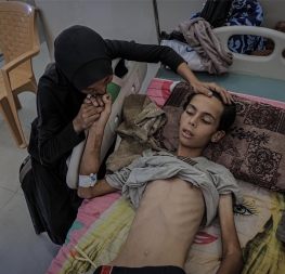 Podvyživené dítě v nemocnici v Gaze, oběť humanitární krize a blokády pomoci – Gaza hladoví